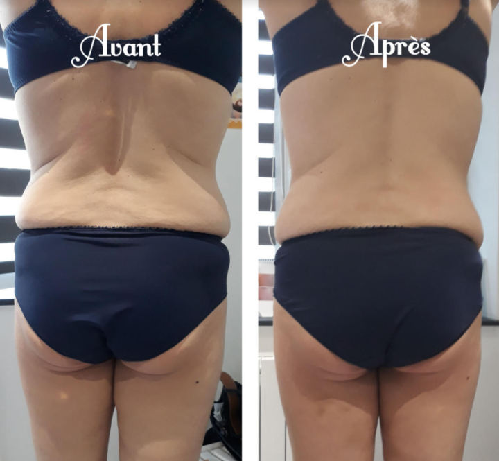 Un institut de soins minceur conseillé à Anet